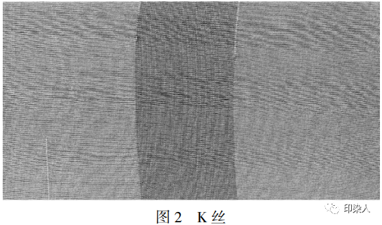 定型機(jī),涂層機(jī),地毯機(jī),地毯背膠機(jī),靜電植絨機(jī)